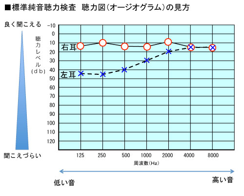 聴力 検査